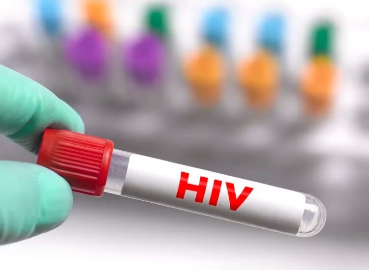 Avance hacia la cura del VIH | lgcba.com